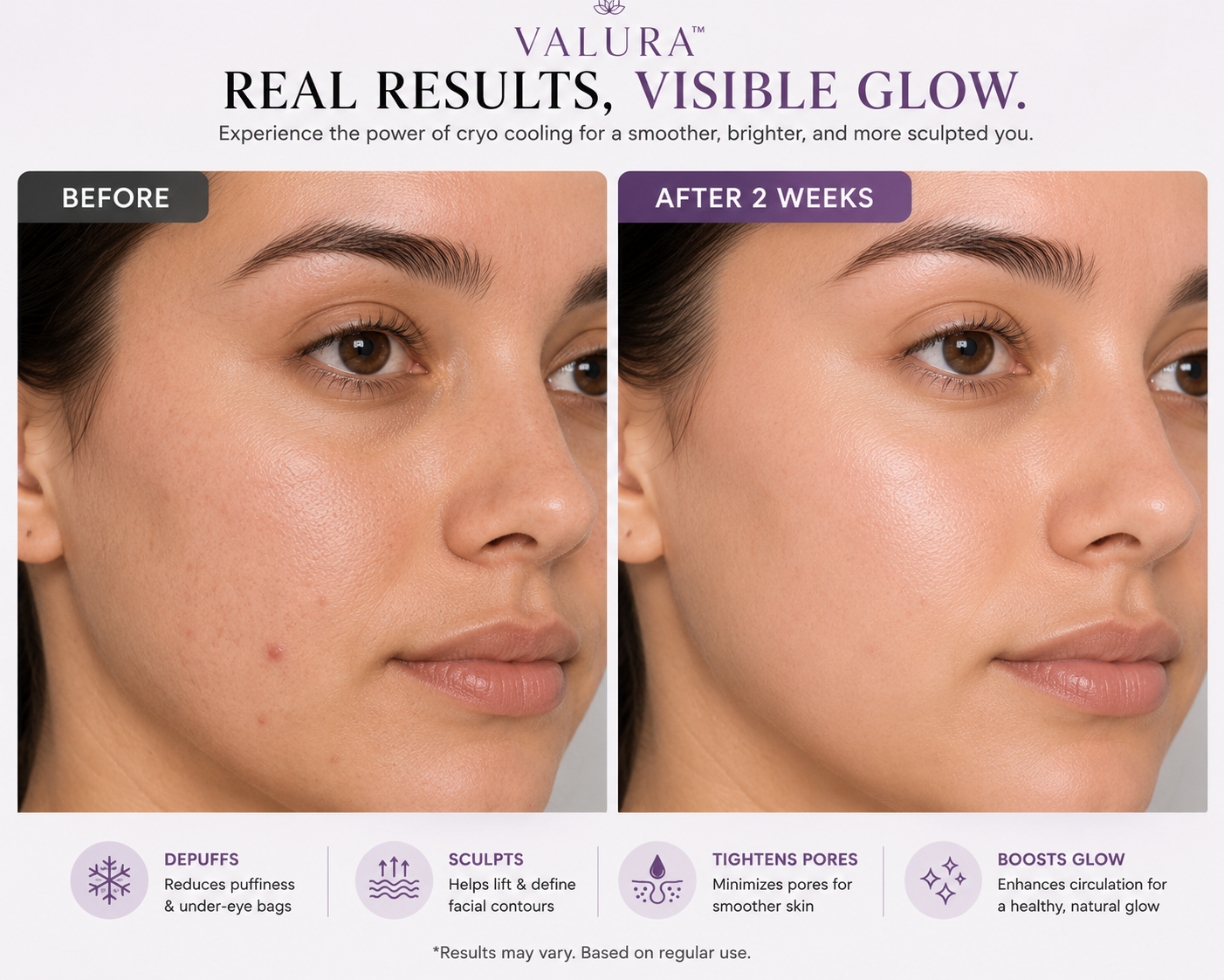 Before and after facial comparison showing the effects of Valura cryo cooling on a woman's face, with text highlighting results after 2 weeks and benefits like depuffing, sculpting, tightening pores, and boosting glow.