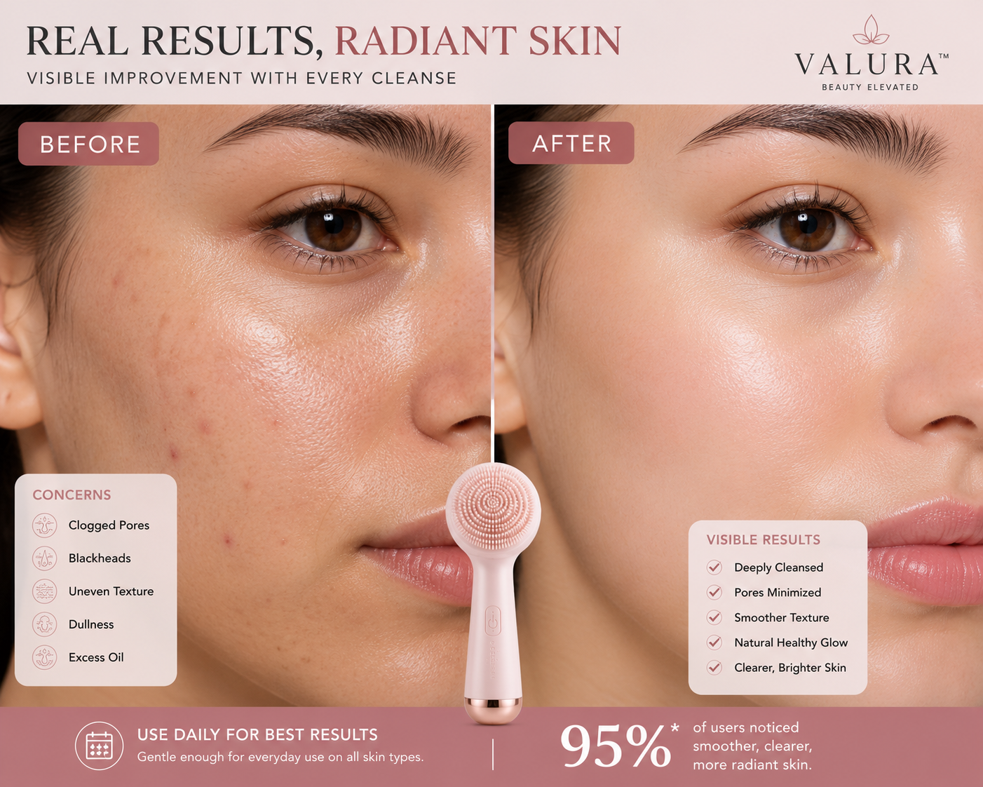 Before and after skincare comparison graphic for Valura Beauty Elevated, showing a woman's face with acne and clear skin results, featuring a pink cleansing brush in the center and text detailing concerns and visible results.