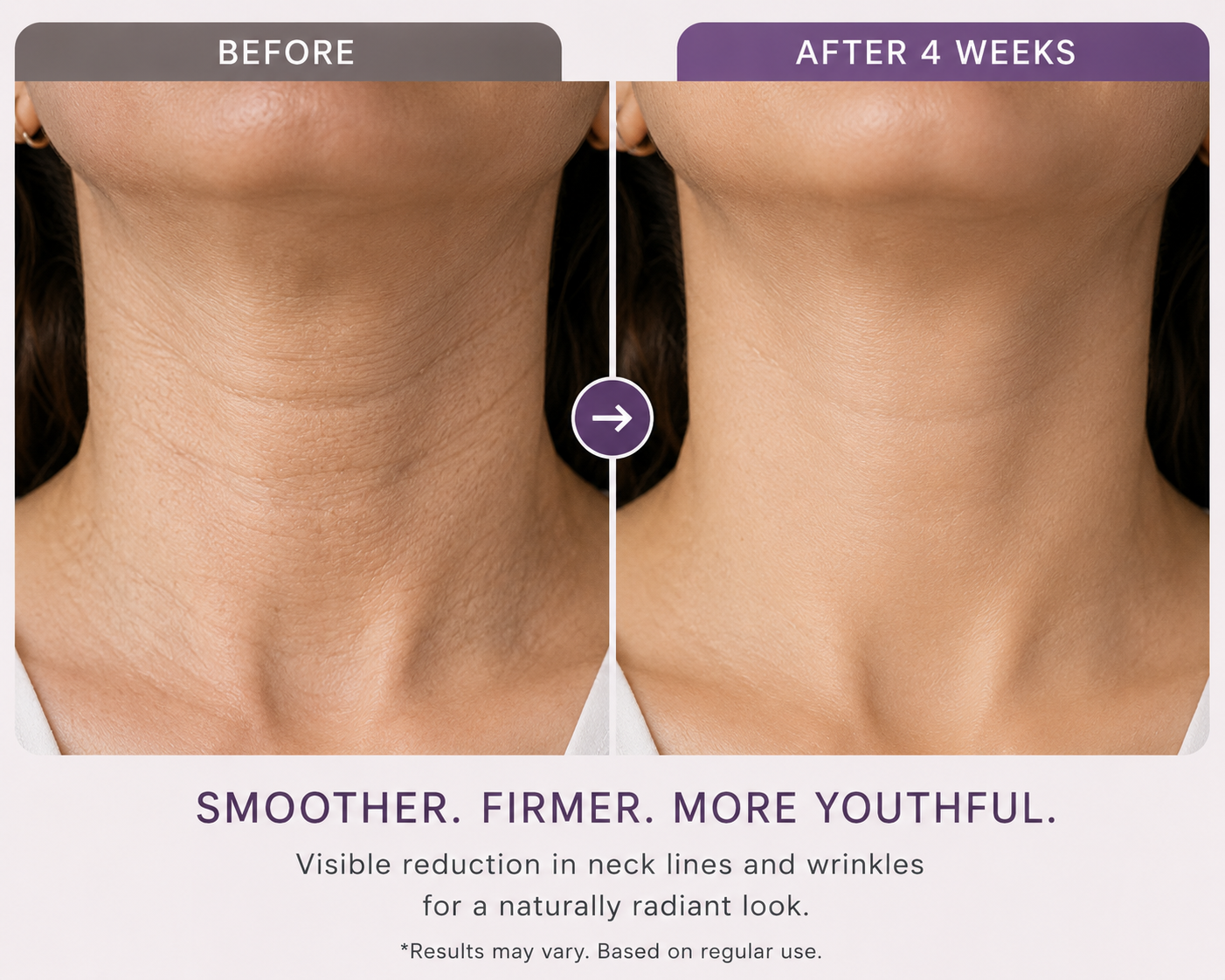 Before-and-after comparison of a woman's neck showing skin texture reduction after 4 weeks, with text reading 'SMOOTHER. FIRMER.